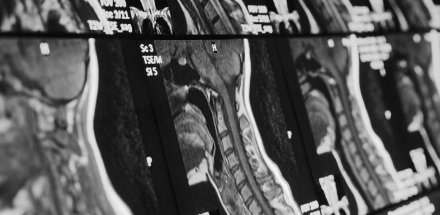 Cambridge Mathematics of Information in Healthcare Hub